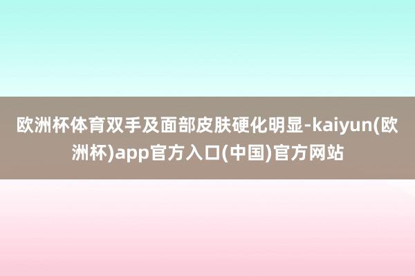 欧洲杯体育双手及面部皮肤硬化明显-kaiyun(欧洲杯)ap